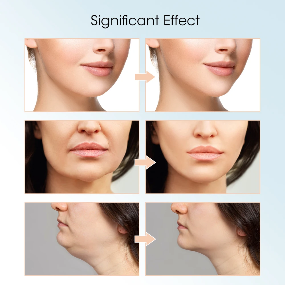 V-Line Face Slimming Lifting Device Massager Skin Rejuvenation Shaping Beauty Instrument Electric Reduce Double Chin Belt